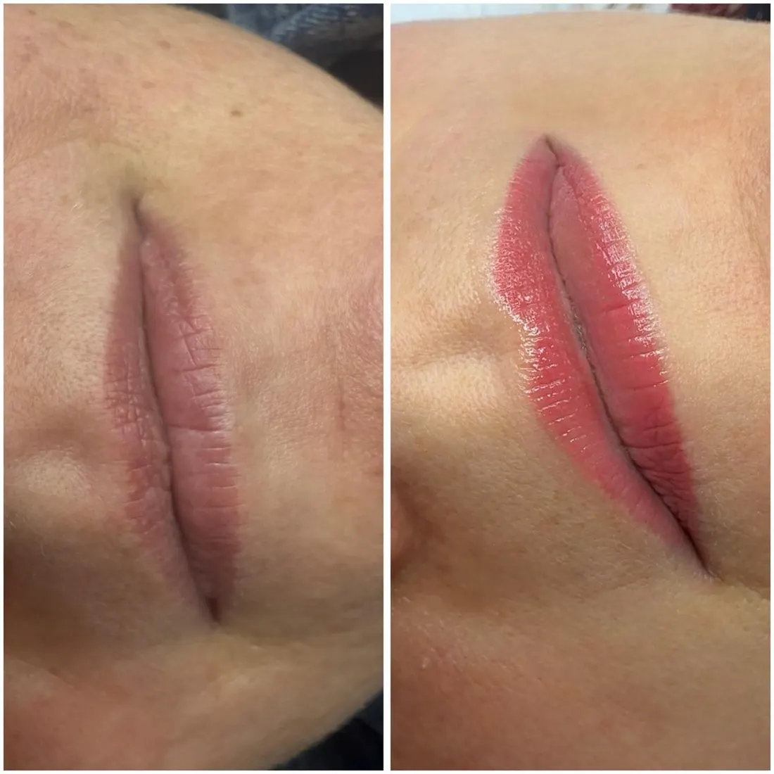 Lippen vorher und nachher